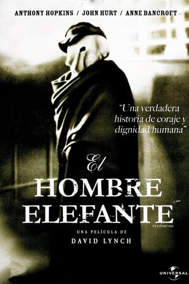 L’home elefant